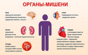 Гипертонический криз